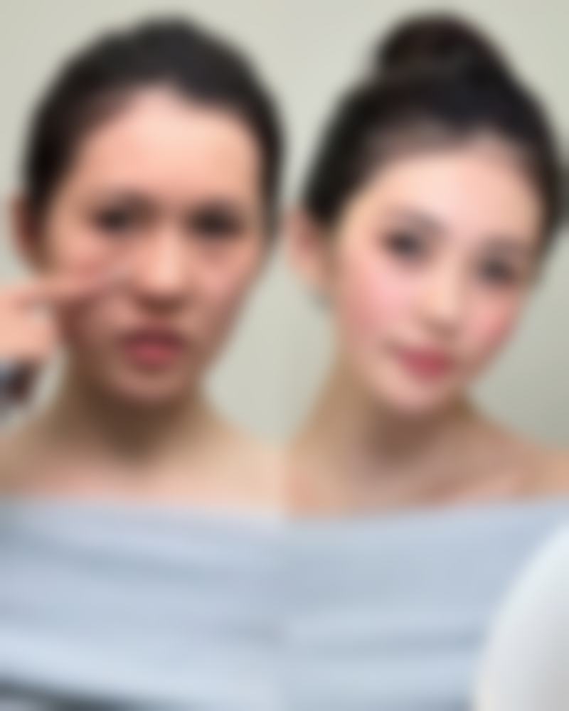 南昌星璨医疗美容门诊部彭圣海医生口碑好评实录