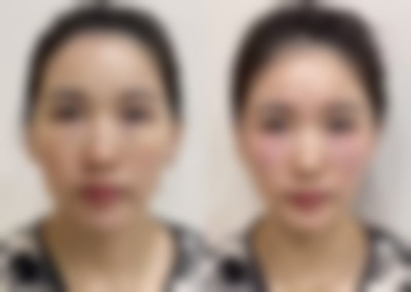 预约优惠活动