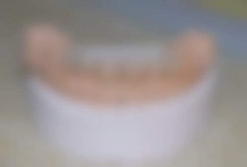 临床实例分享:治疗成效如何?