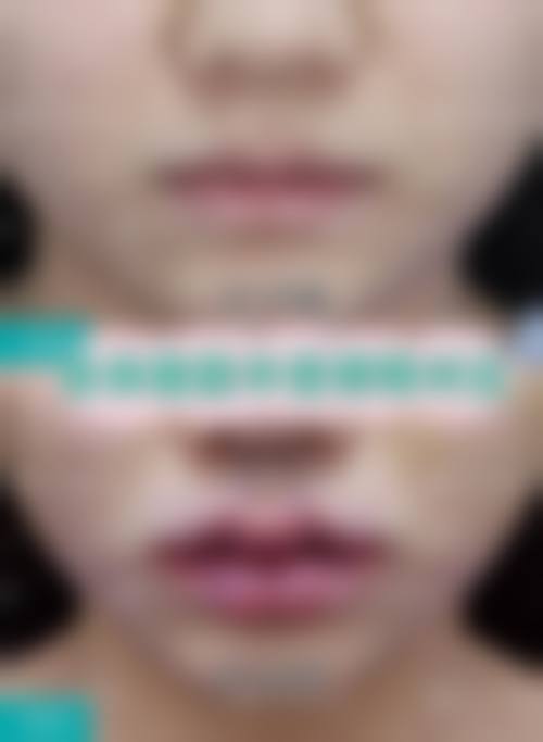 总结与预约指引