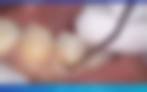 结尾预约号召：把握优惠立即行动