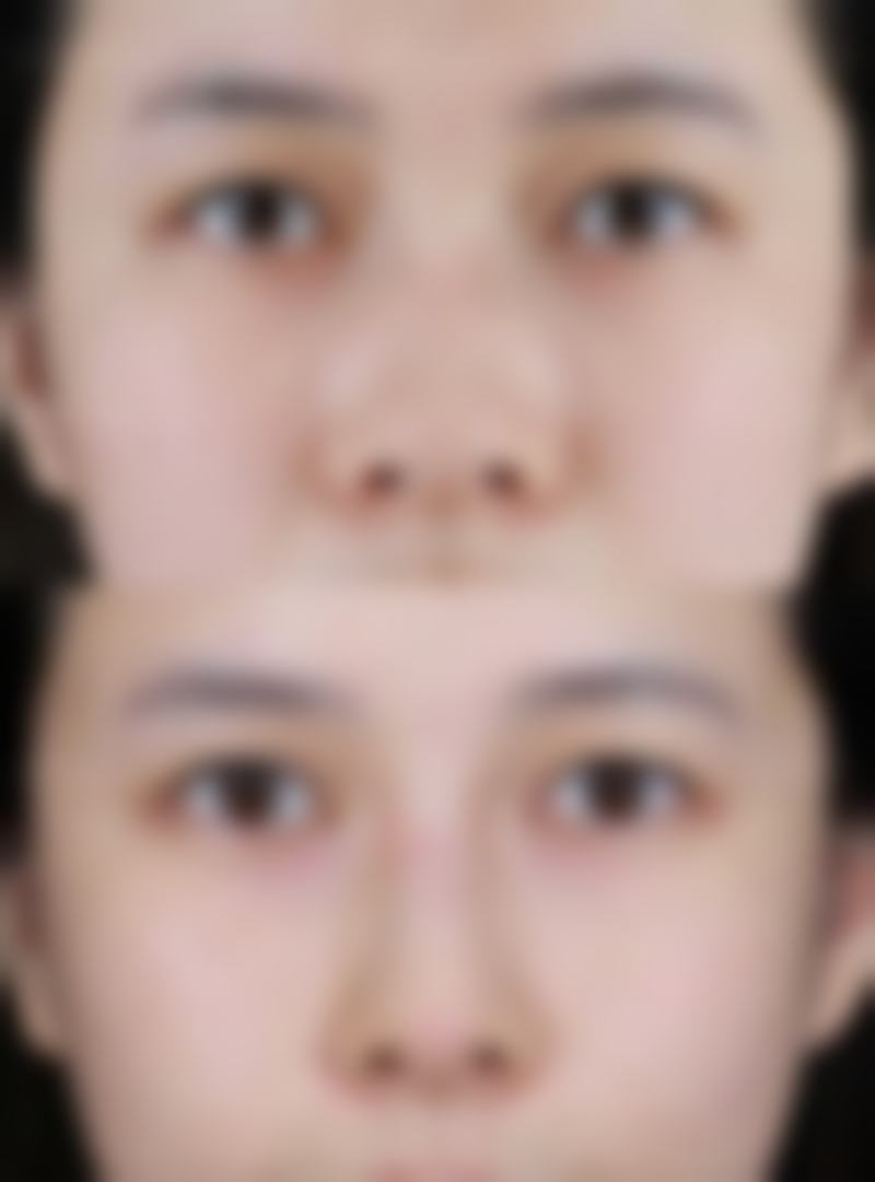 北京伊美尔健翔整形美容医院收费价格表(2026年参考)