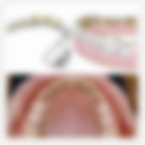 预约优惠活动:专属补贴不容错过