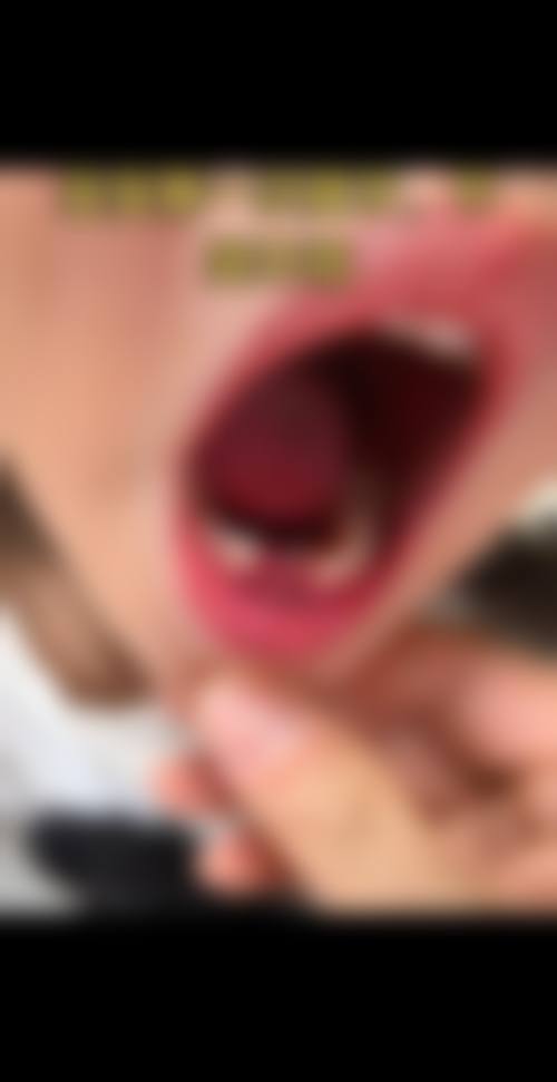 患者真实评价