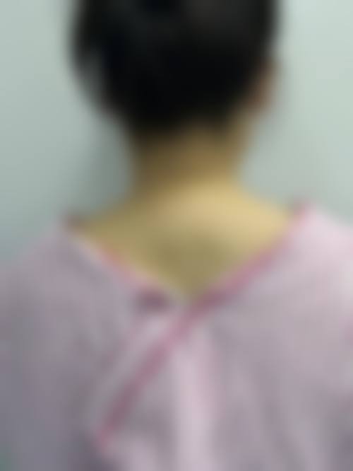 患者真实评价:来自求美者的声音