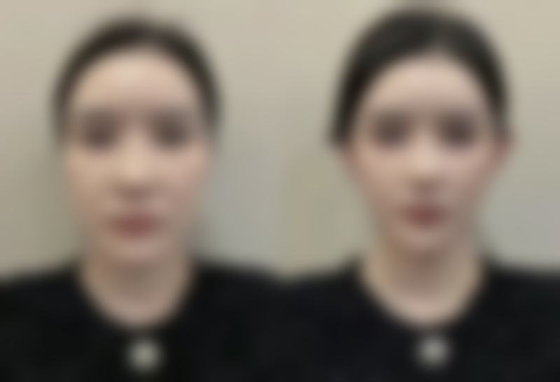 长春爱美整形医院口碑如何?真实用户评价精选