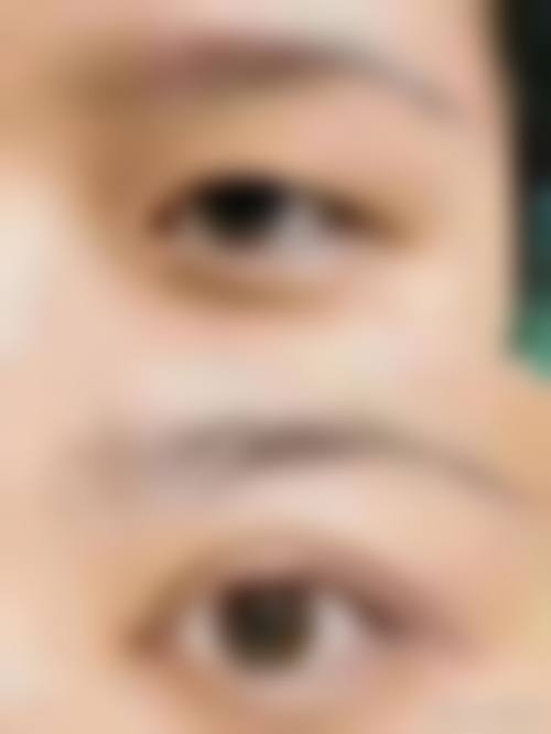 韩国特艺整形外科常见问答解析