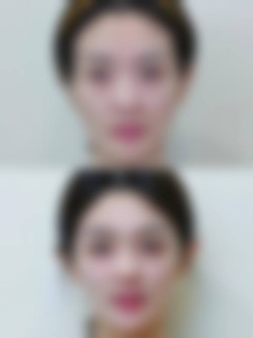 江西 南昌韩美整形美容机构预约挂号与服务指南