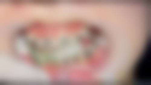 预约优惠活动：现在就诊有什么补贴？