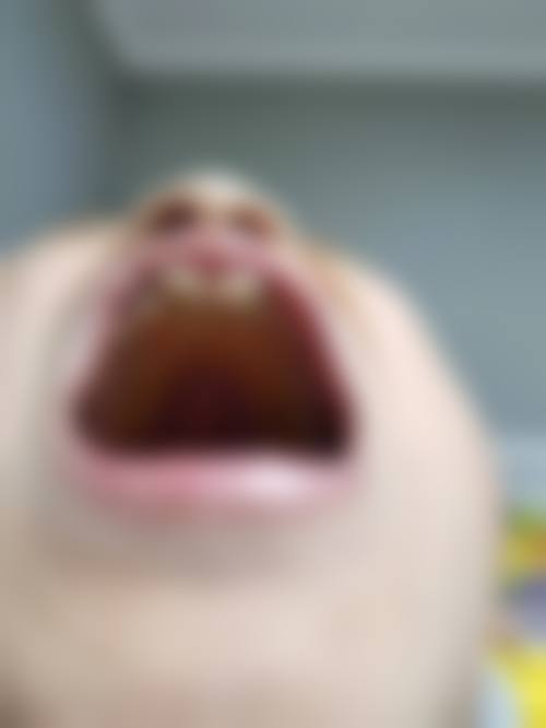 总结与预约号召