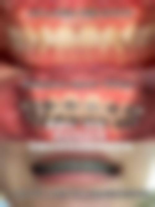 临床实例分享：找张华凤医生治疗能达到一样的成效吗？