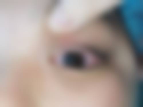 高端设备加持精细诊疗眼底与眼表疾病