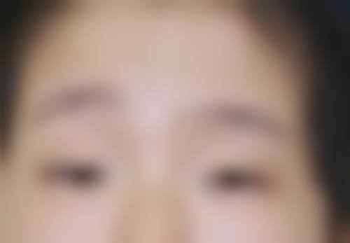 诊疗特色总结德宏州人民医院眼科杨淑娟