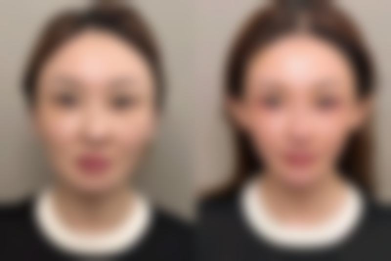 韩国特艺整形外科预约挂号方式