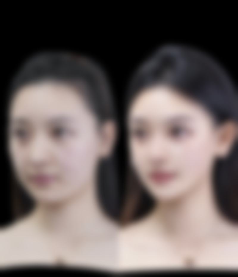 江西 南昌韩美整形美容机构高频问答