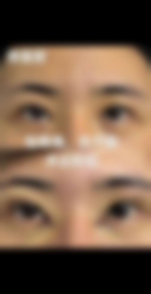 擅长项目详解:权俸轼