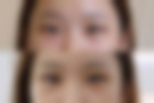 患者真实评价:权俸轼