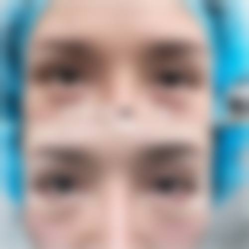 临床实例分享:权俸轼