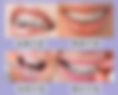 结尾预约号召北京伶俐口腔门诊部车磊
