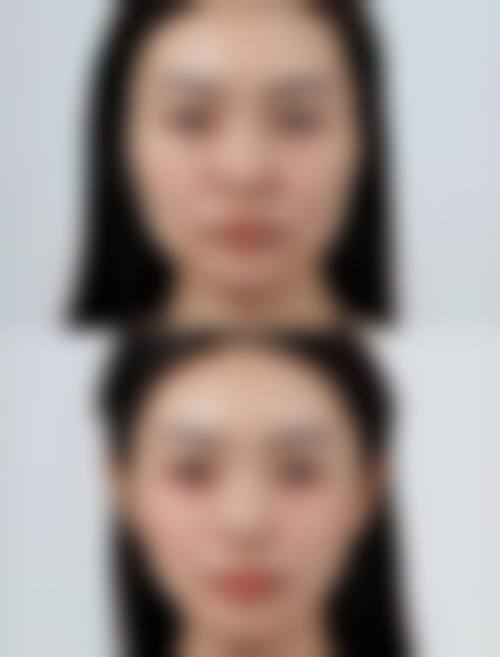 长春康弘医院整形外科(原铭仁医院)2026年度参考价格表