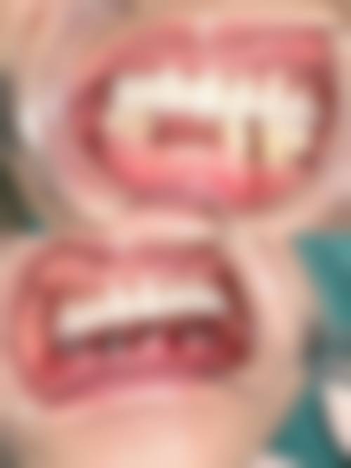 擅长项目详解重庆存济口腔医院戴红卫