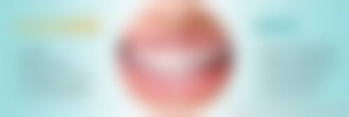 临床实例分享