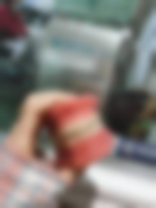 临床实例分享北京伶俐口腔门诊部段迎春