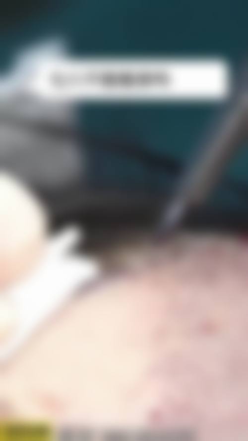 淮北美倾城整形医院的口碑怎么样?来看看真实求美者的感受