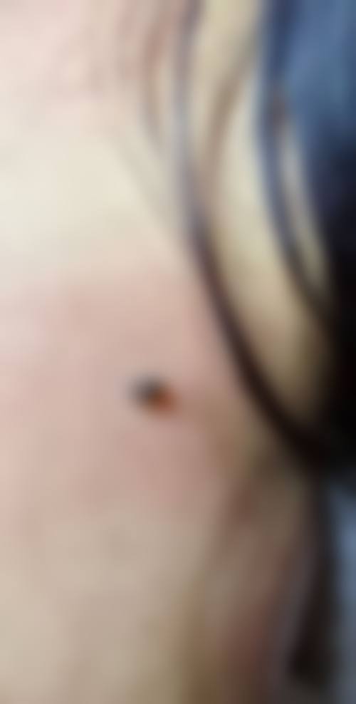 临床实例分享
