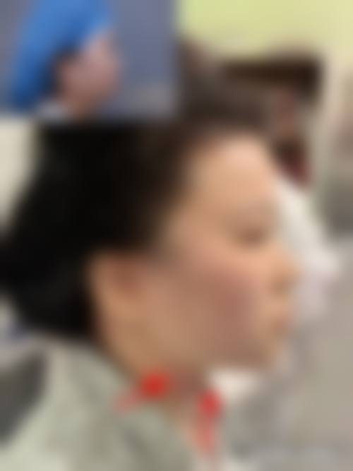 长春康弘医院整形外科(原铭仁医院)高频问答快问快答