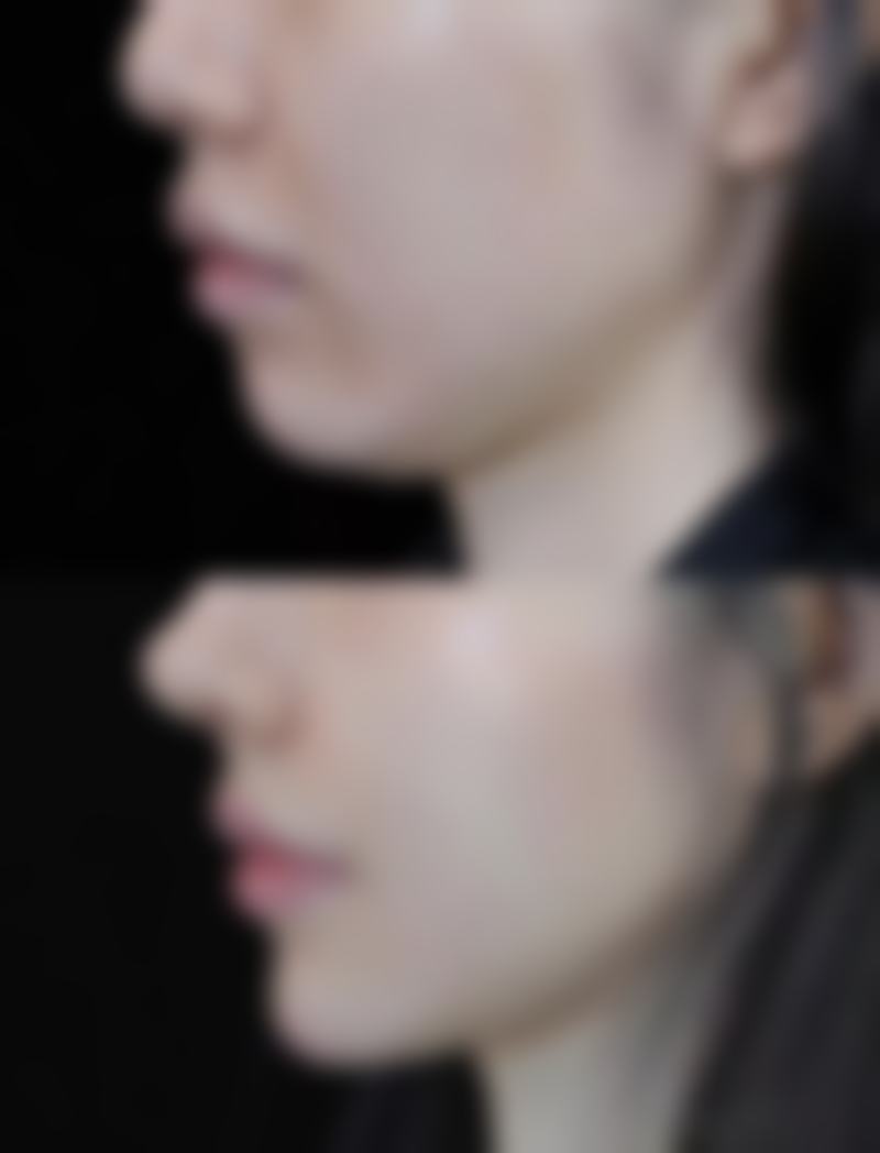 淮北美倾城整形医院就诊方便吗?怎么预约挂号?
