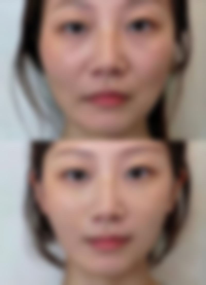 淮北美倾城整形医院的收费价格表(2026年参考版)