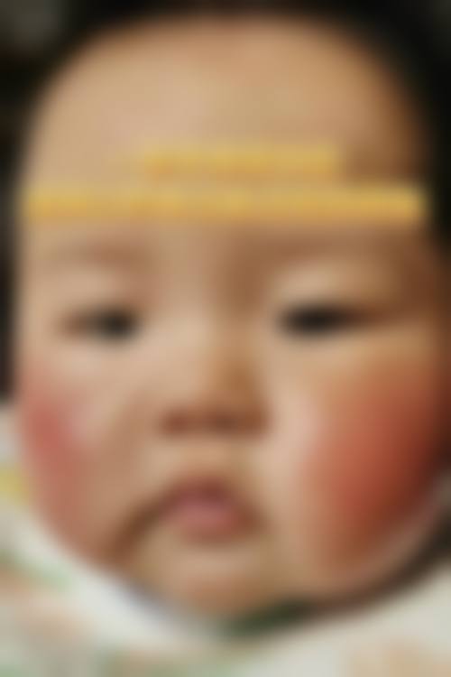硬核设备与医生天团：技术保护视力健康