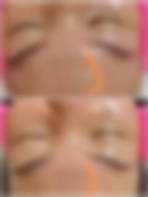 擅长项目详解