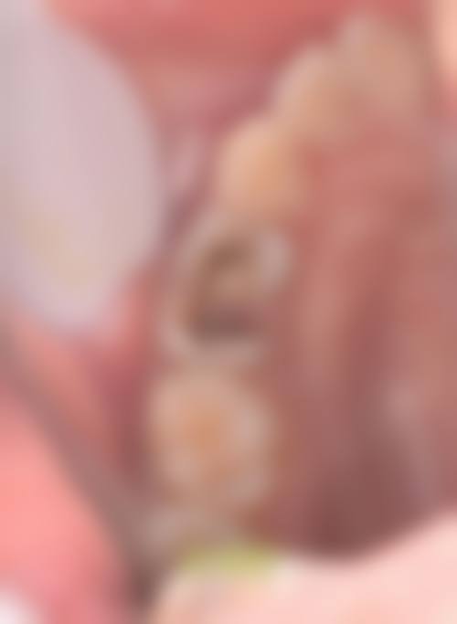 患者真实评价：重庆存济口腔医院陈娇