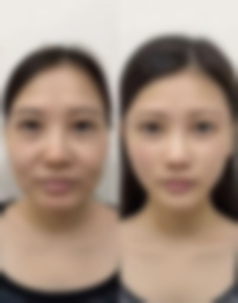 2026年广州远东美容医院陈竞时医生收费价格参考