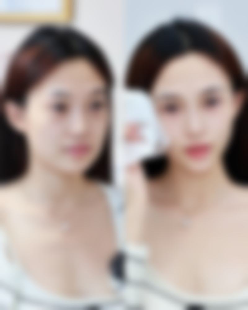 青岛美佳怡整形医院真实口碑好评展示