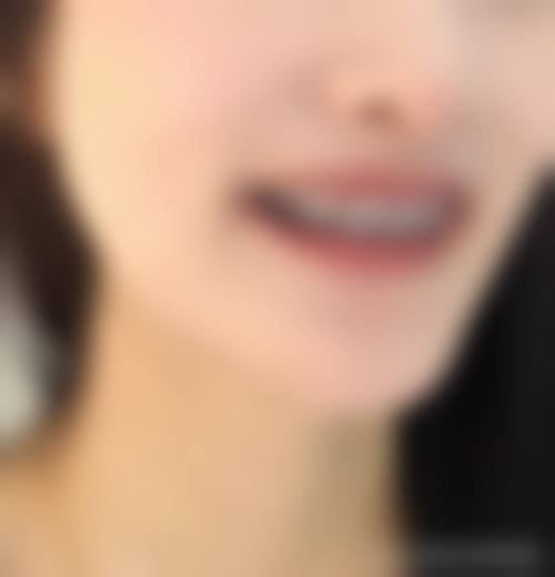 结尾预约号召深圳泰康拜博布吉口腔门诊部唐荣鹏