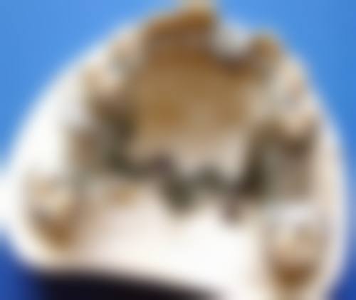 结尾预约号召:上海永华口腔门诊部秦风显