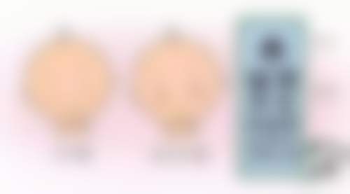 无锡金瞳眼科医院医生团队与技术优势有哪些？
