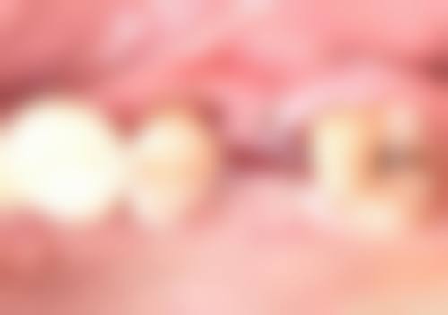 患者真实评价深圳泰康拜博布吉口腔门诊部唐荣鹏