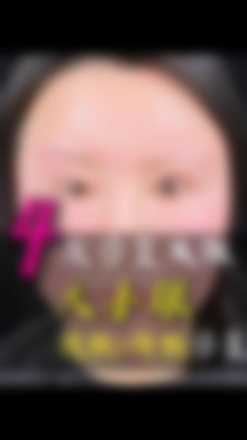 患者真实评价:威海市荣成伊美王晋如