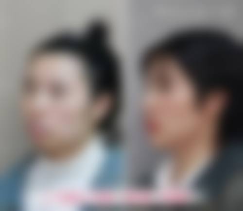 擅长项目详解:适合我的牙齿情况吗?