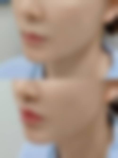 诊疗特色总结:威海市荣成伊美王晋如