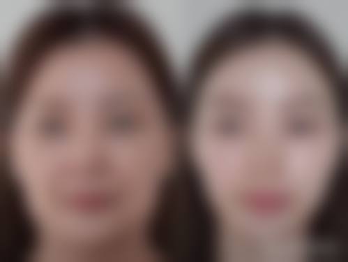 透明收费与优惠活动详情