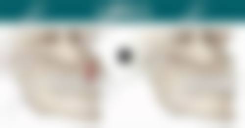 常见问题解答