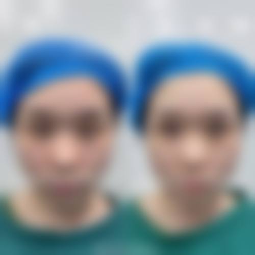 结尾预约号召：抓住机会守护视力
