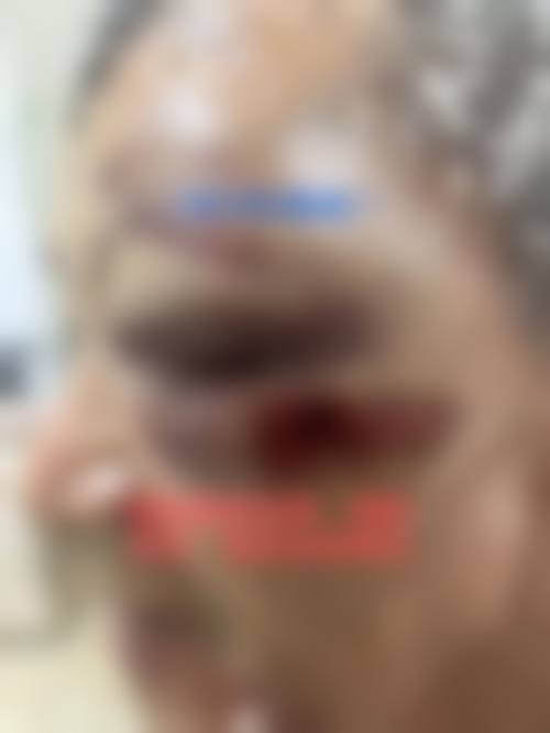 结尾预约号召：把握机会，重拾光明
