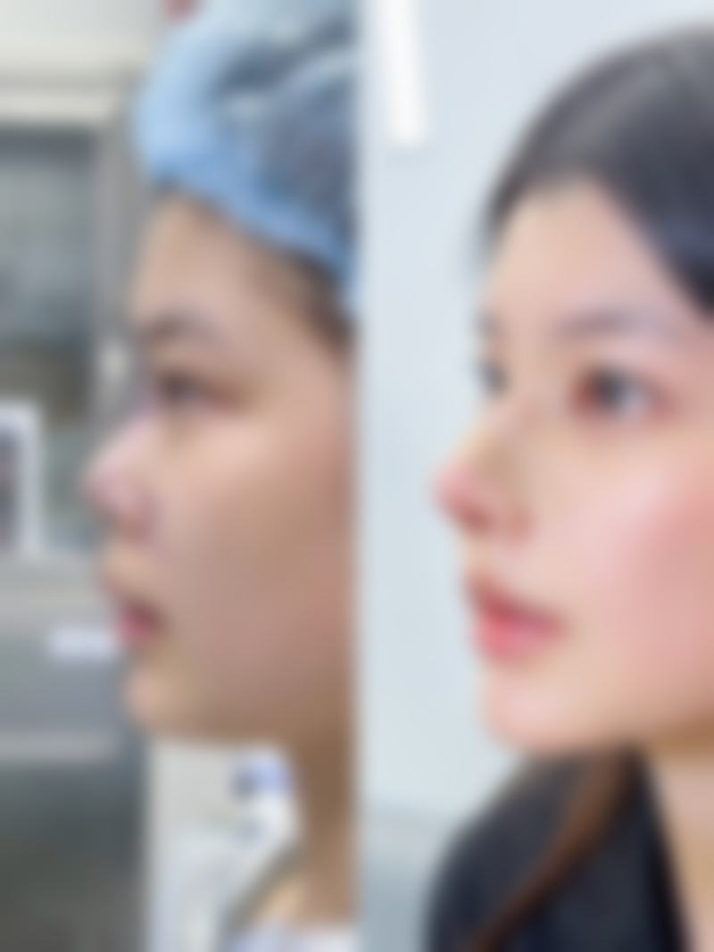 太仓仁慈医院整形科王益利医生擅长项目与技术特色