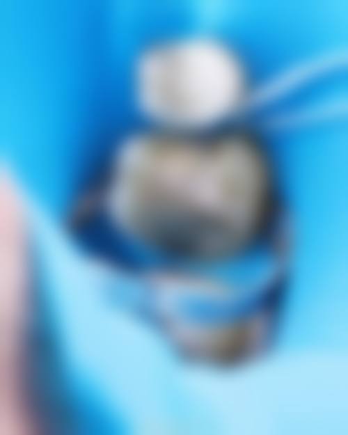 临床实例分享:南昌德亚口腔门诊部姜奉孝医生实例真实吗?